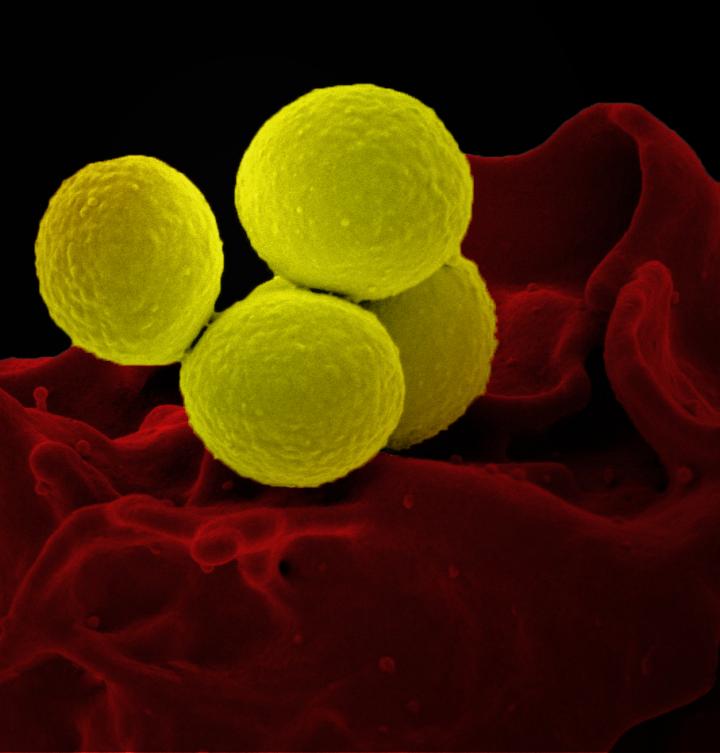 human neutrophil ingesting methicillin-resistant Staphylococcus.