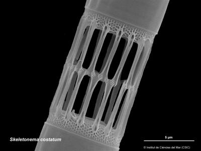 The Explosion of Marine Diatoms Is Linked to Continental Erosion