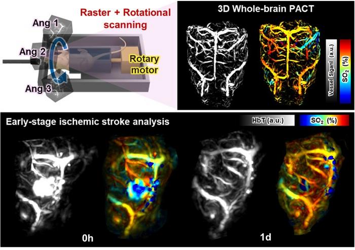 Visualization of the entire cerebrovascular structure and observation of acute ischemic stroke lesions using PACT on the entire brain