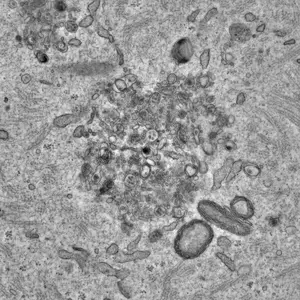 Oocytes outsmart toxic proteins to preserve l - Vimarsana News