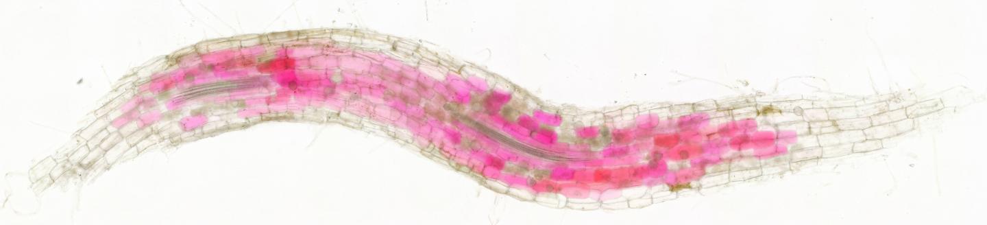 Cells of roots colonised by fungi turn red (3)
