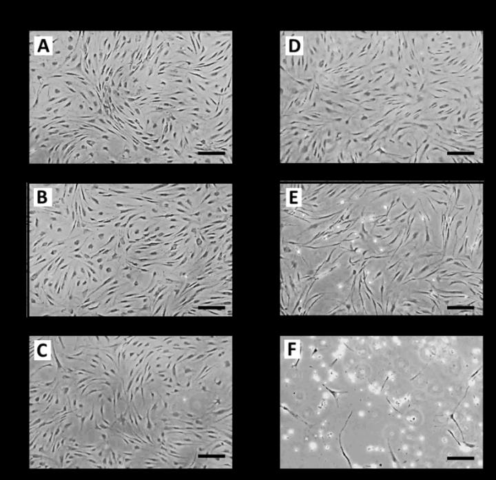 SDHI Pesticides Are Toxic for Human Cells