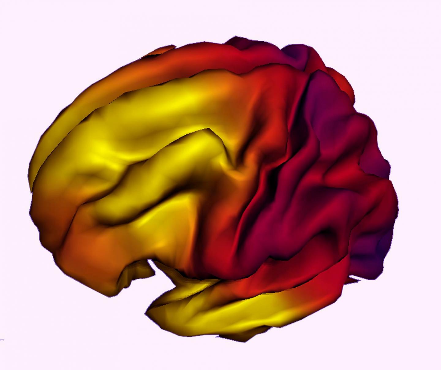 Brain Image