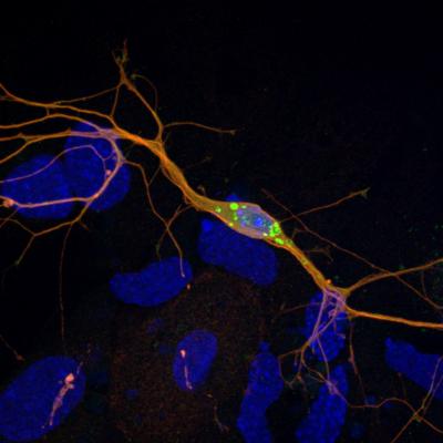 Lewy Body-like Inclusions in Mouse Neurons
