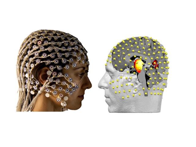 The Electroencephalogram