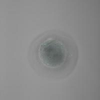 Fertilized Egg (Zygote) with No Maternal Chromosomes