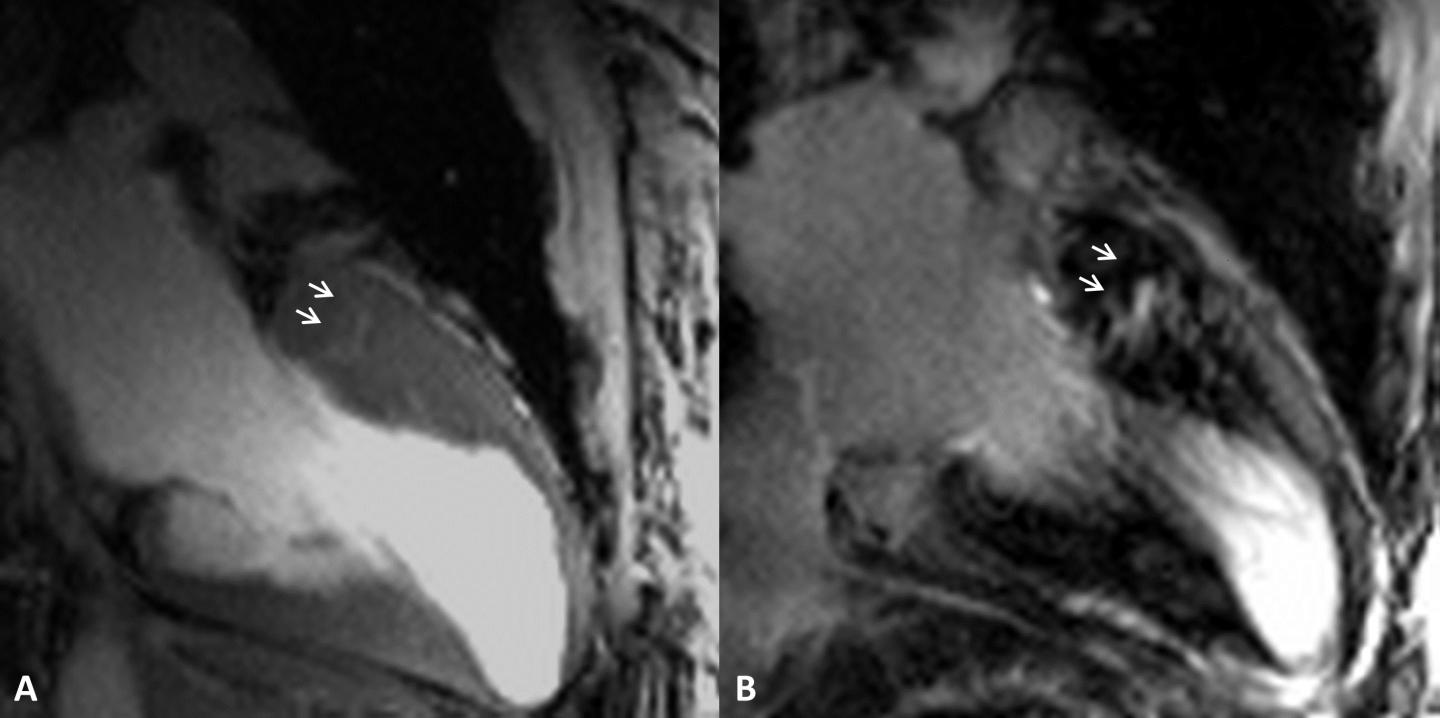 7T and 3T MRI