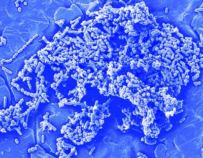 Bacterial Biofilm Targeted