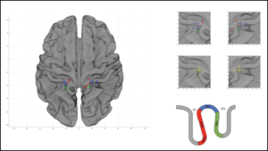 How the Female Brain Responds to Genital Touch