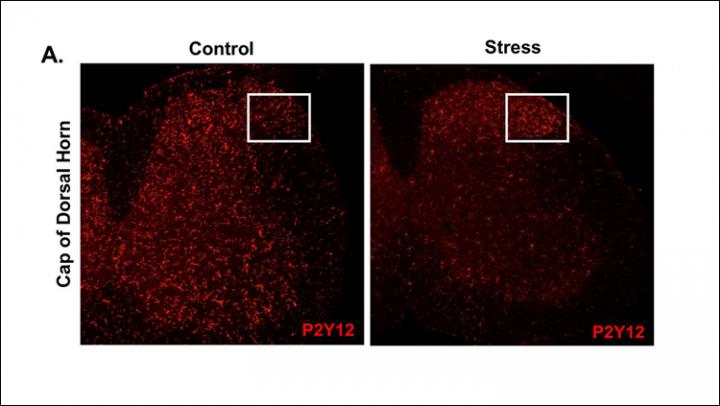 Microglial Activation