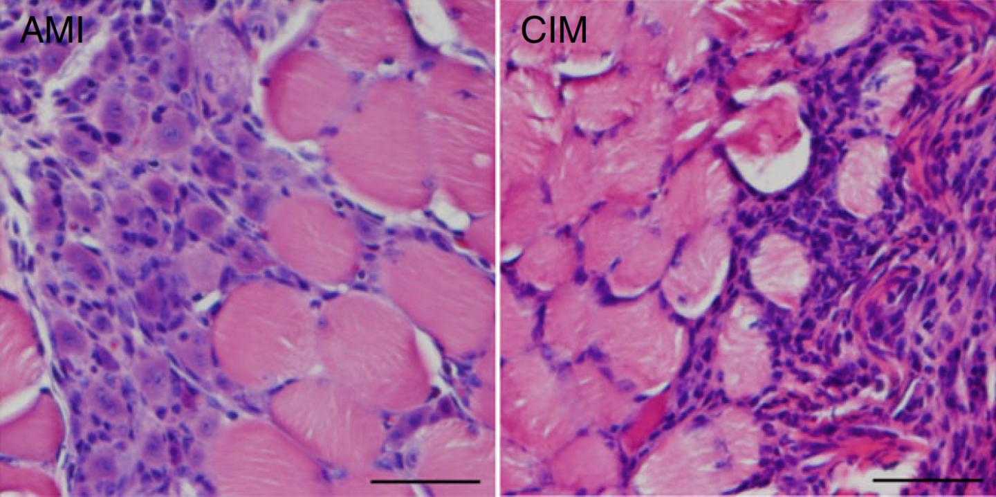 Mice Muscle Cells after Acute Muscle Injury or with Chronic Inflamatory Myopathy