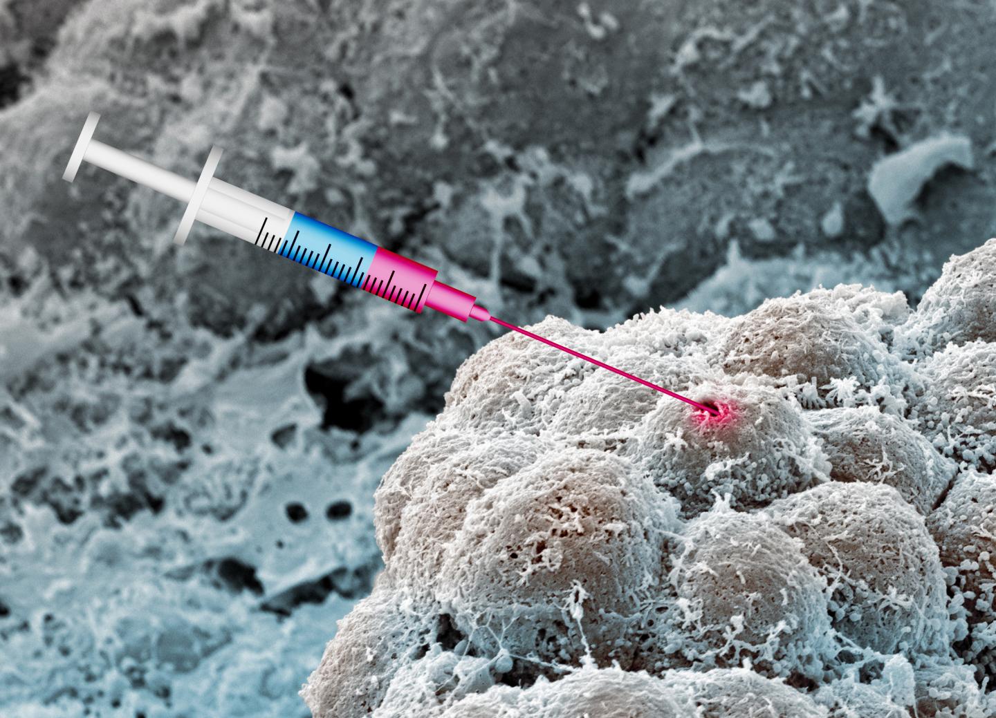 Treating Cancer With Drugs for Diabetes and Hypertension