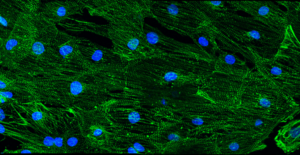 Stem cell-derived cardiomyocytes