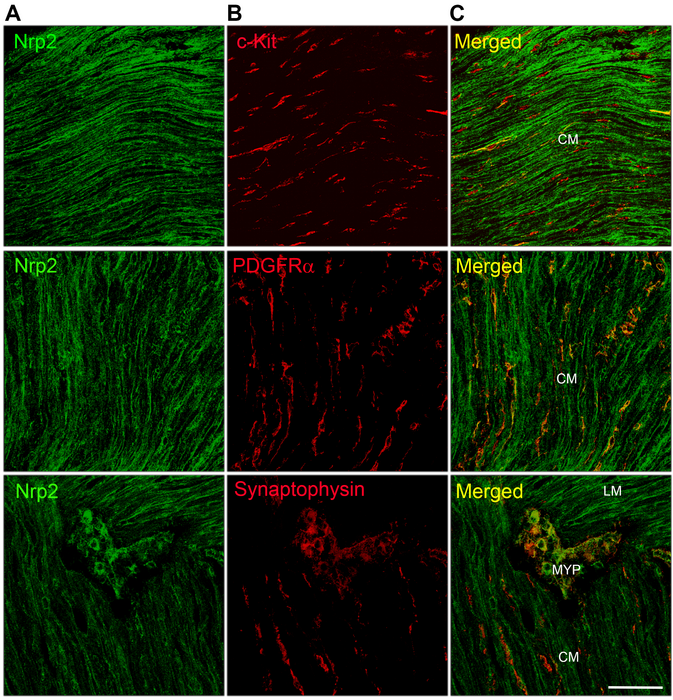 New study identifies potential therapeutic targets for colon disease