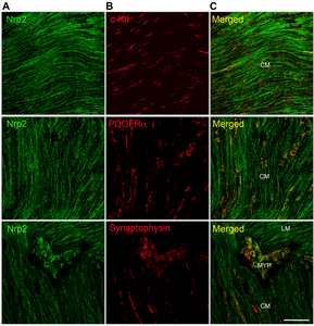 New study identifies potential therapeutic target for colonic disorders