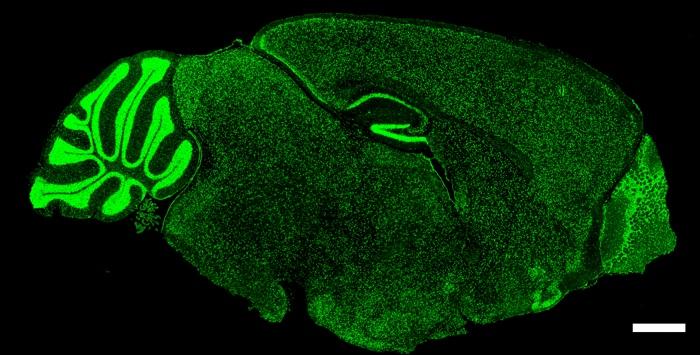 Brain Image of Mouse Lacking Fragile X Mental Retardation Protein