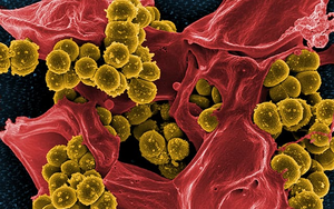 Staphylococcus aureus