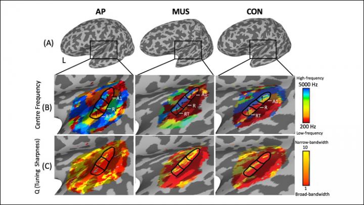 Tonotopic Maps