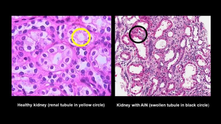 Kidney Tissue