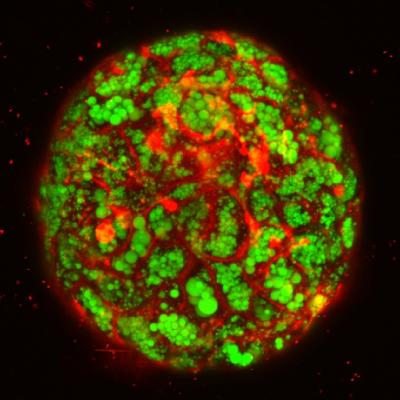 Confocal Imaging of Fatty Liver Organoid in a Dish