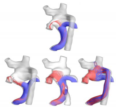 Pre- and Post-Surgery Hepatic Dlow