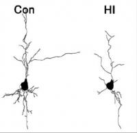 Stephen Back Neuron Tracing Figure 2