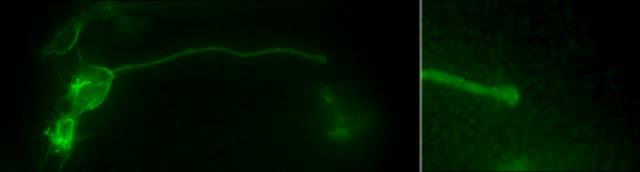 Developing Neurons Leave Their Footprints (3 of 4)