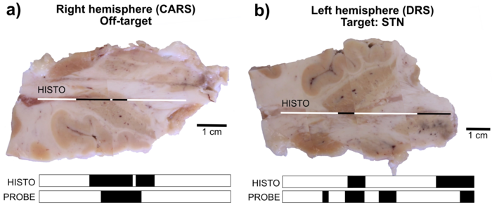 Tissue slices of the left and right hemispheres