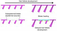 Hair follicle stem cells contribute to blister healing
