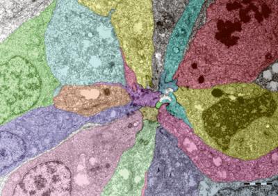 Developing Zebrafish Patchwork