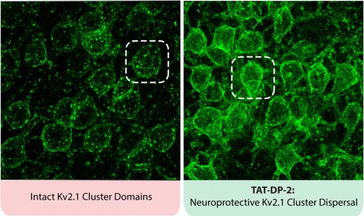 Potassium Channels Disperse with New Drug