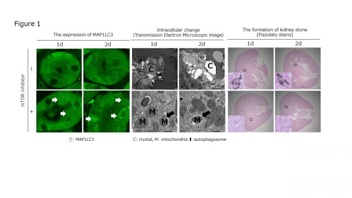 mTOR Inhibition Suppresses Kidney Crystal Formation