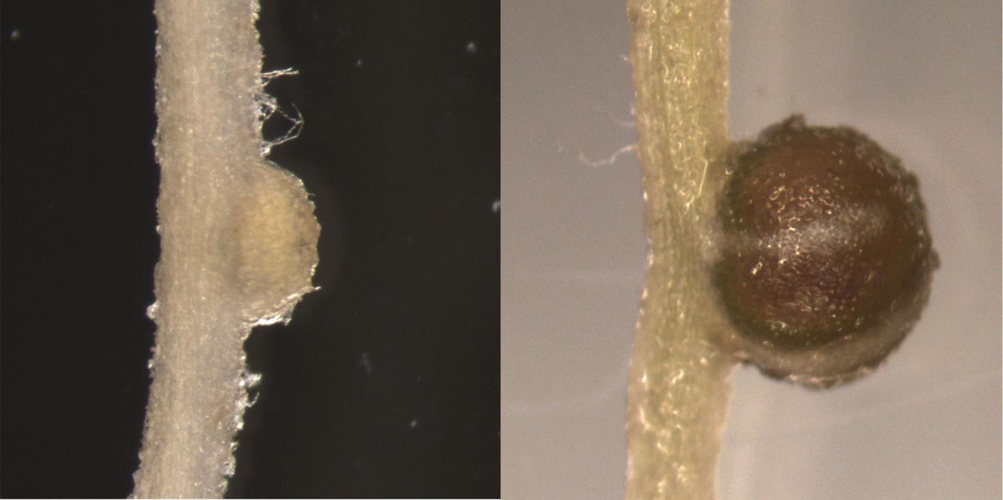 Uninfected and Infected Root Nodules