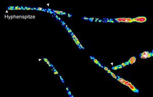 Loss of the RNA-binding protein Khd4 disrupts membrane trafficking