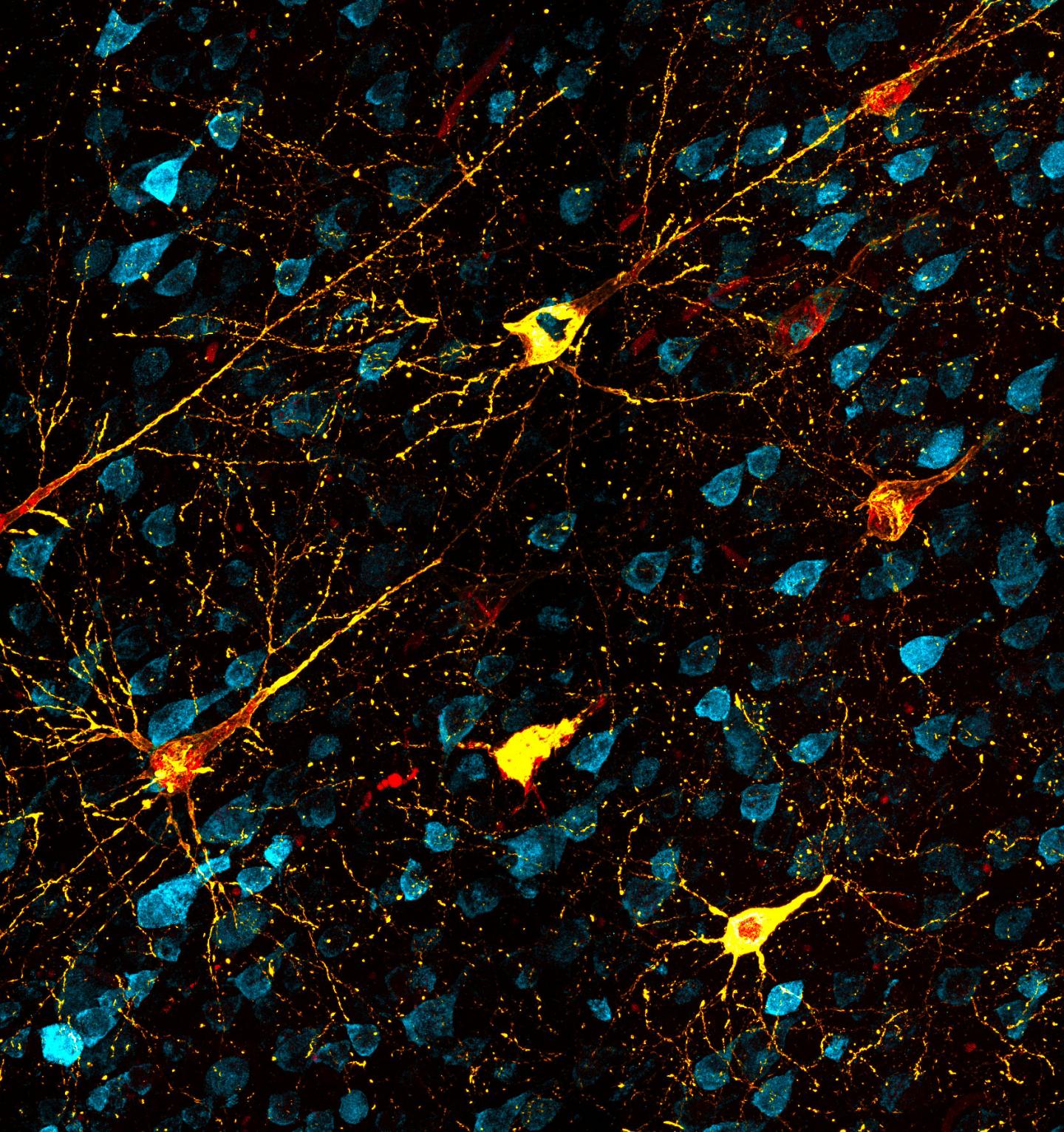 Animal Model Opens Way to Test Alzheimer's Disease Therapies