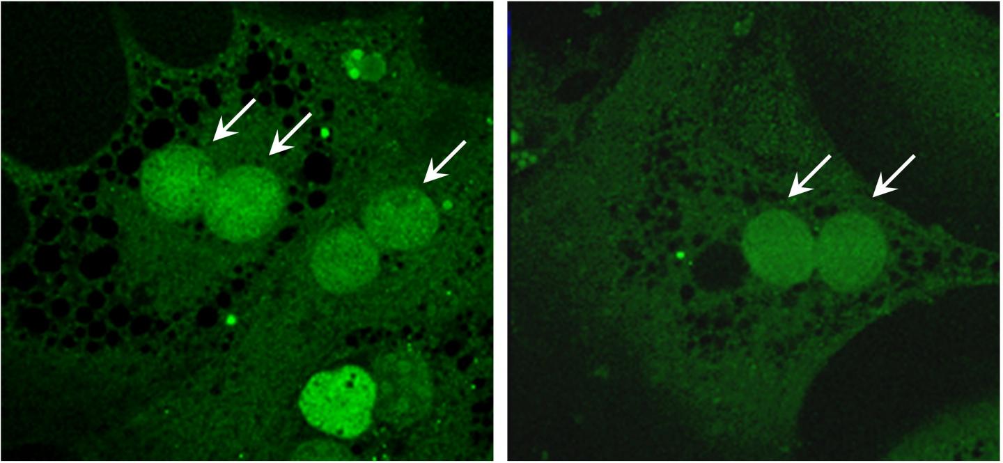 Accumulation of Glucose Sensor ChREBP in the Nucleus After Glucose Stimulation