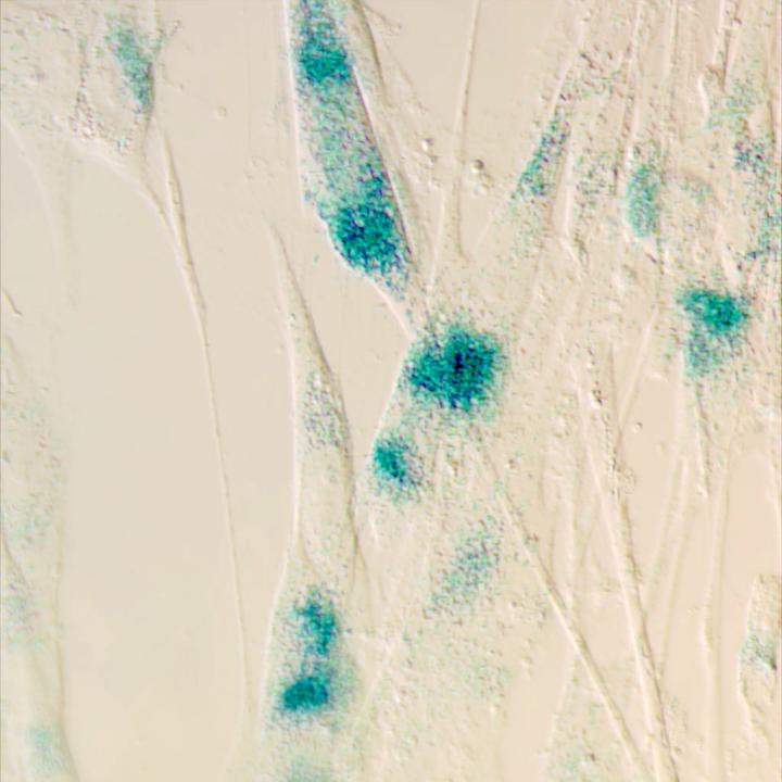 Senescent Cells (Closer Up)