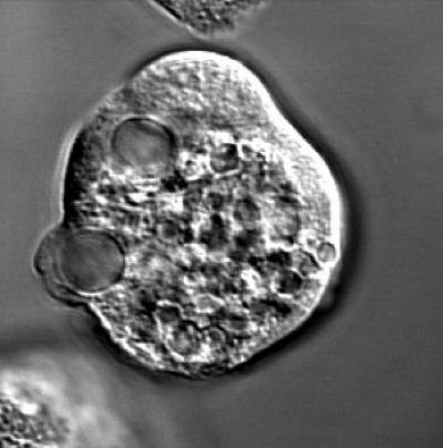 <i>Entamoeba histolytica</i>