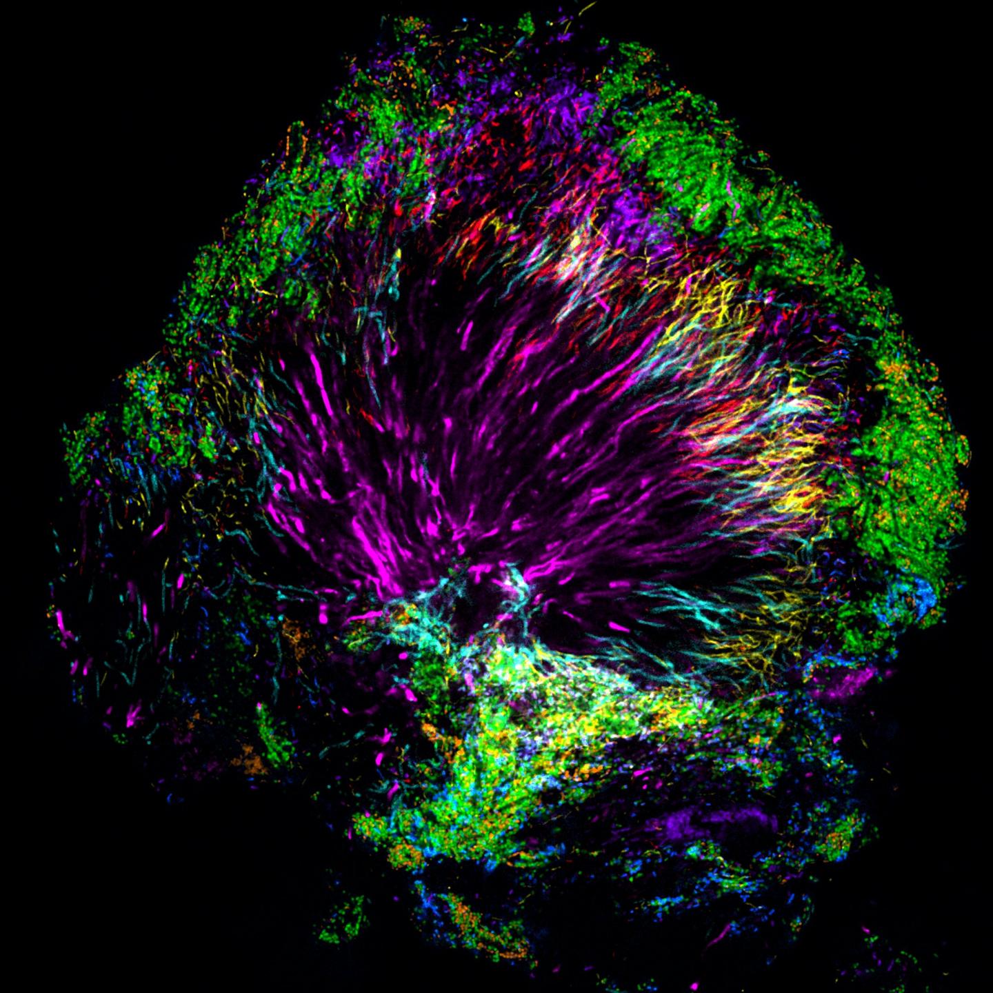 A Plaque Microbiome Community