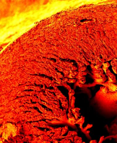 Complex Coordination