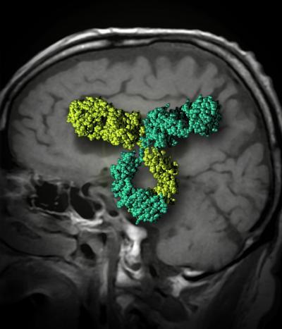 Slipping Antibodies Into The Alzheimer's Brain (5 of 5)