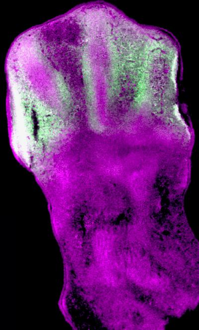 Section Through a Developing Mouse Embryonic Arm and Hand
