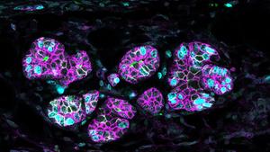 Alveoli in the second pregnancy recovering milk production function after removal of the RANK protein.