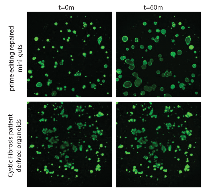 Prime editing corrects organoids