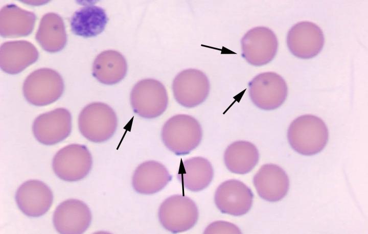 Hemoplasma Organisms