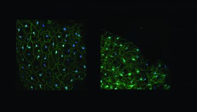 Insulin Response in Overfed Adult Fruit Flies
