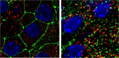 Pancreatic Beta Cells