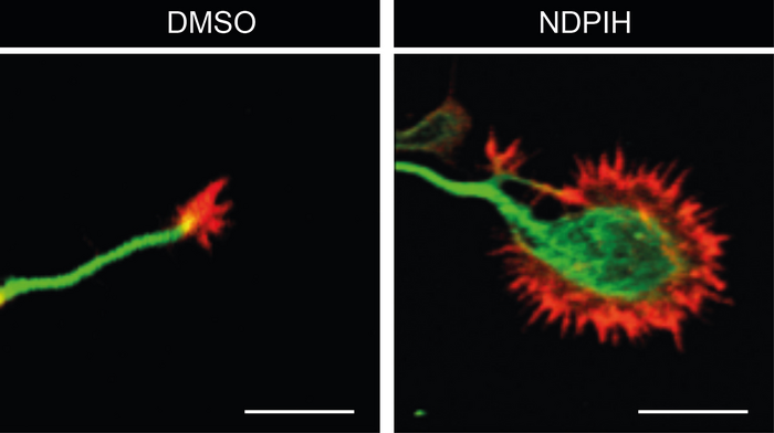 Comparison of the control and treated neuron growth cones