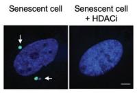 Treating Senescent Cells with an FDA-Approved HDAC Inhibitor Decreased Cytoplasmic Chromatin