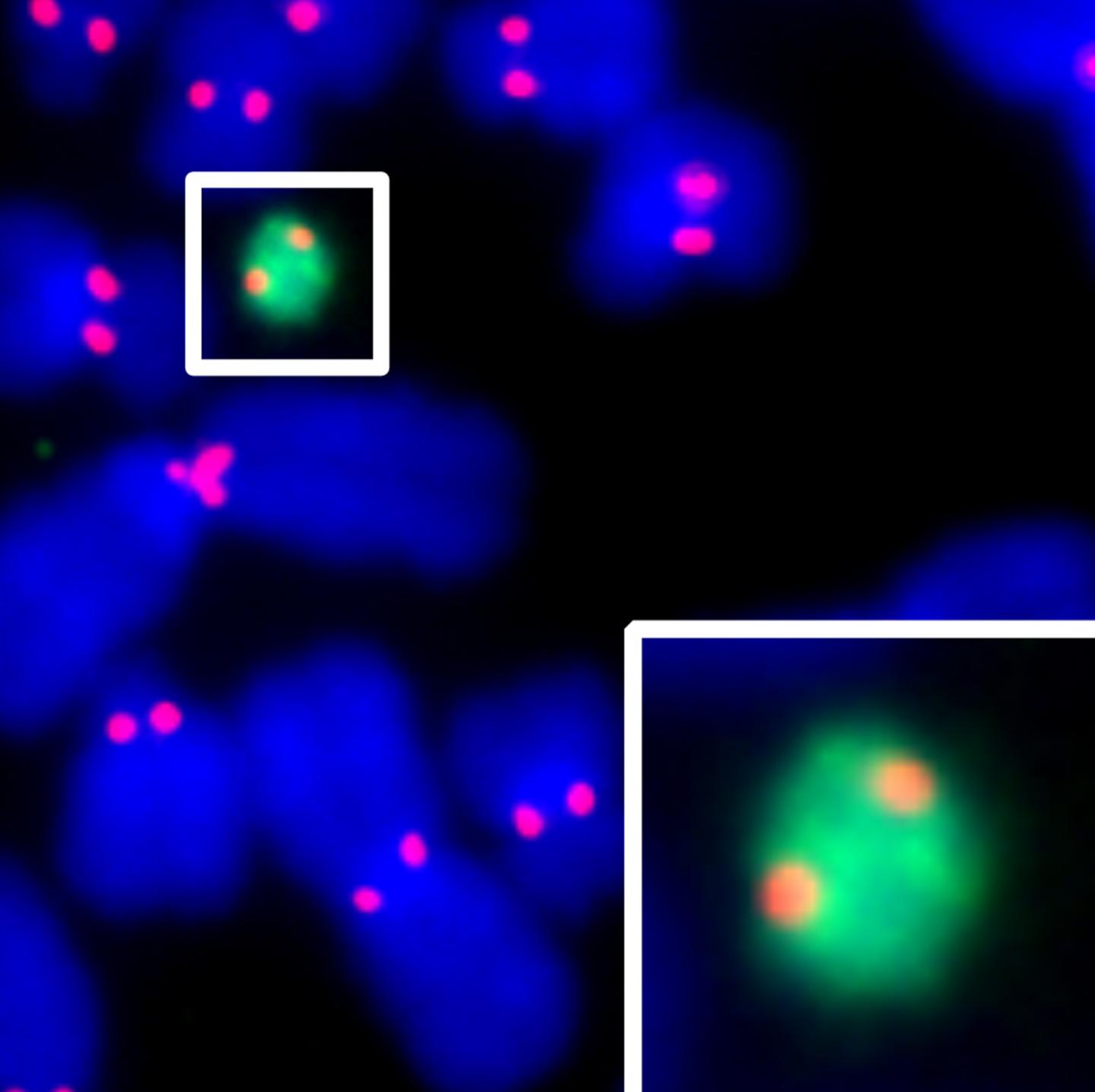 Adding a Centromere